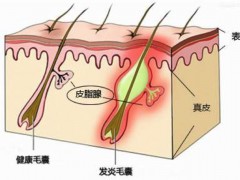 鸡皮肤竟然是一种病态，赶紧看看