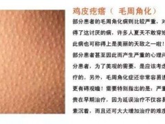 为什么会有鸡皮肤不看不知道