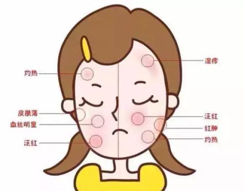 脸部出现红血丝怎么办，反馈效果好