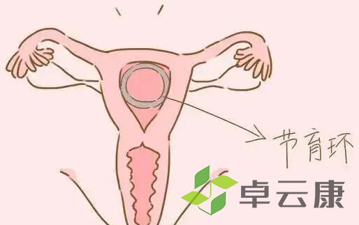 姐