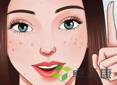 痘痘10