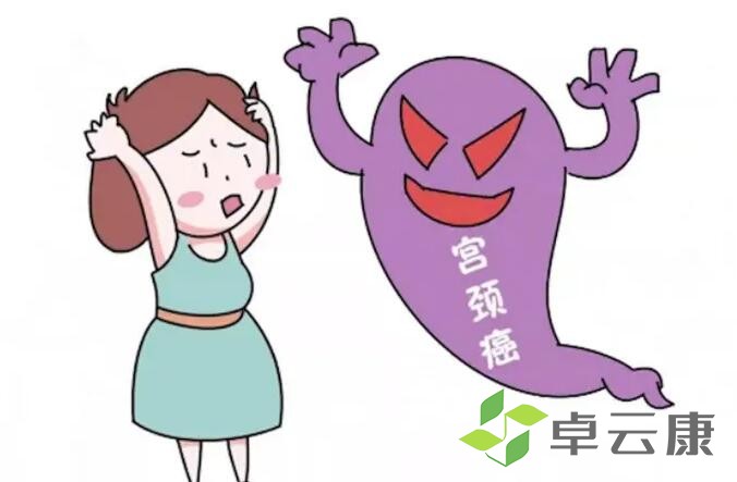 宫颈癌