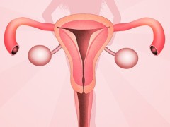 治疗子宫肌瘤最好的办法是什么？子宫切除术治疗子宫肌瘤效果如何？