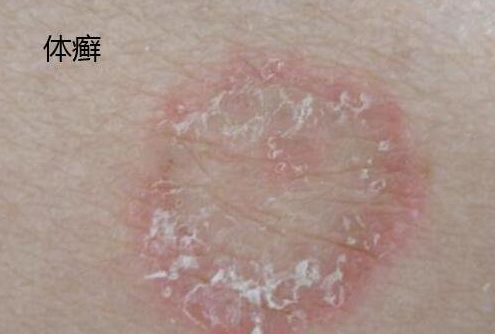 微信截图_20230111171606