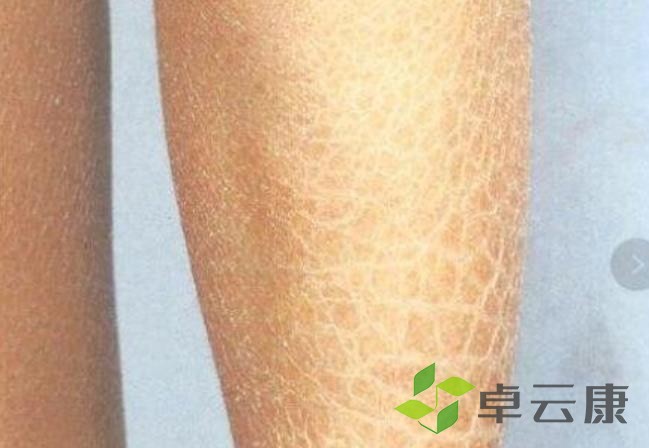 360截图20230131224708102