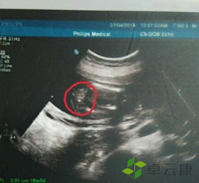 360截图20230203232256492