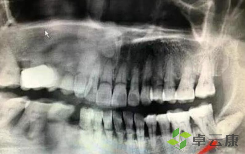 360截图20230208231845464