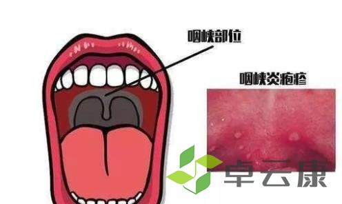 炎症