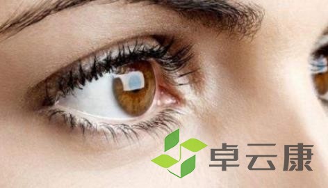 眼睛
