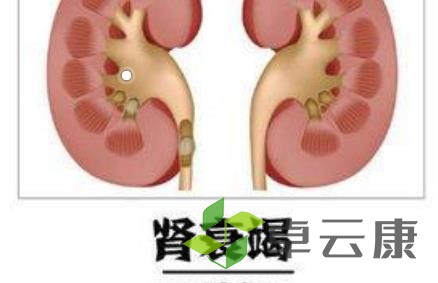 肾衰竭