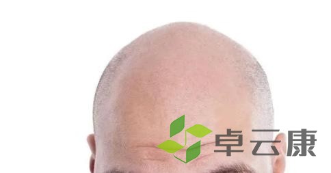 20230401160553